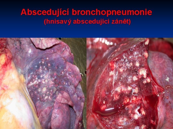 Abscedující bronchopneumonie (hnisavý abscedující zánět) 