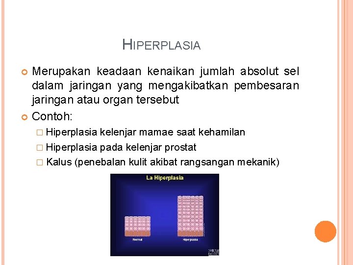 HIPERPLASIA Merupakan keadaan kenaikan jumlah absolut sel dalam jaringan yang mengakibatkan pembesaran jaringan atau