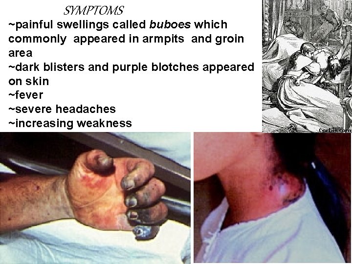 SYMPTOMS ~painful swellings called buboes which commonly appeared in armpits and groin area ~dark