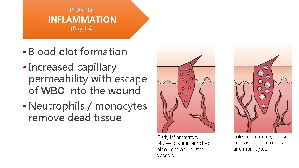 PHASE OF INFLAMMATION (Day 1 -4) • Blood clot formation • Increased capillary permeability