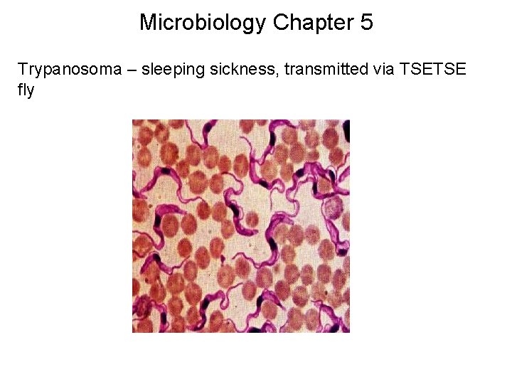 Microbiology Chapter 5 Trypanosoma – sleeping sickness, transmitted via TSETSE fly 