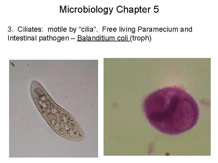 Microbiology Chapter 5 3. Ciliates: motile by “cilia”. Free living Paramecium and Intestinal pathogen