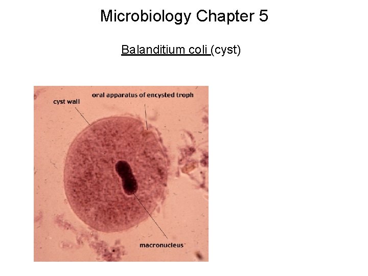 Microbiology Chapter 5 Balanditium coli (cyst) 