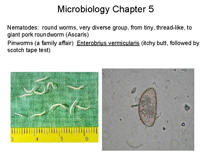 Microbiology Chapter 5 Nematodes: round worms, very diverse group, from tiny, thread-like, to giant