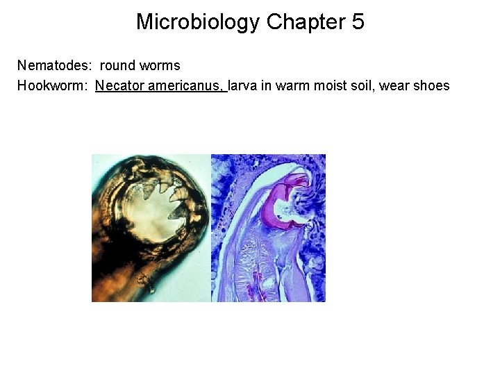 Microbiology Chapter 5 Nematodes: round worms Hookworm: Necator americanus, larva in warm moist soil,