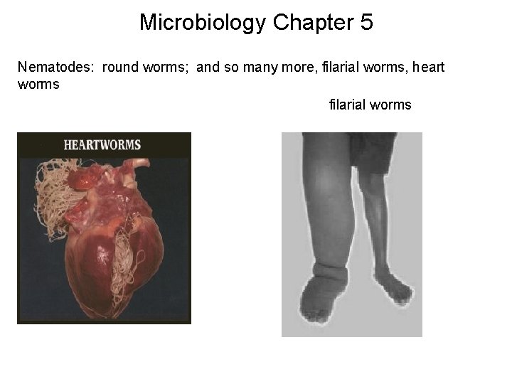 Microbiology Chapter 5 Nematodes: round worms; and so many more, filarial worms, heart worms