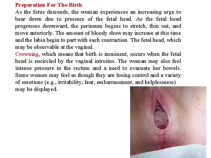 Preparation For The Birth As the fetus descends, the woman experiences an increasing urge