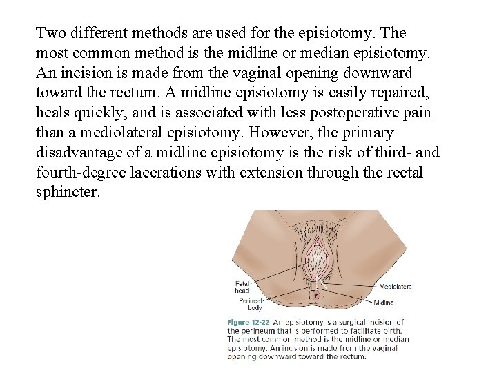 Two different methods are used for the episiotomy. The most common method is the