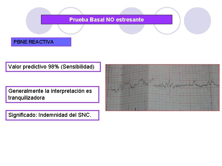 Prueba Basal NO estresante PBNE REACTIVA Valor predictivo 98% (Sensibilidad) Generalmente la interpretación es