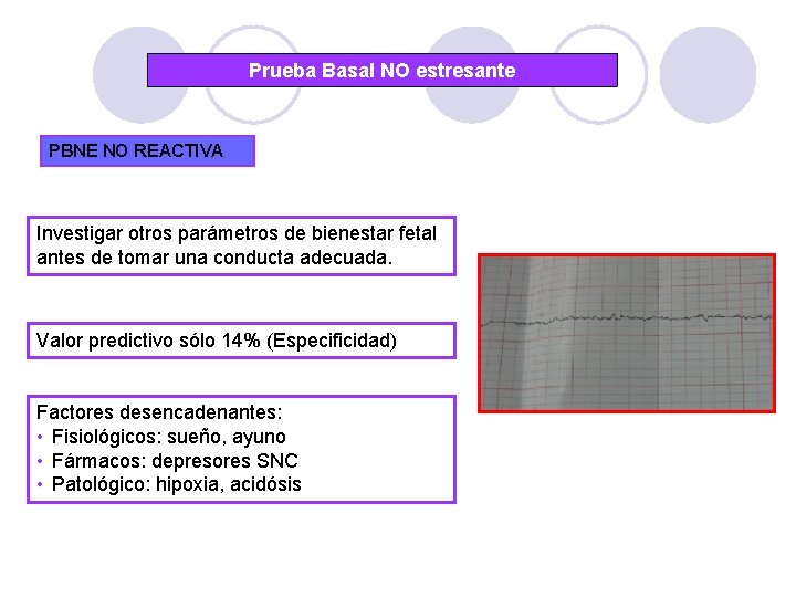 Prueba Basal NO estresante PBNE NO REACTIVA Investigar otros parámetros de bienestar fetal antes