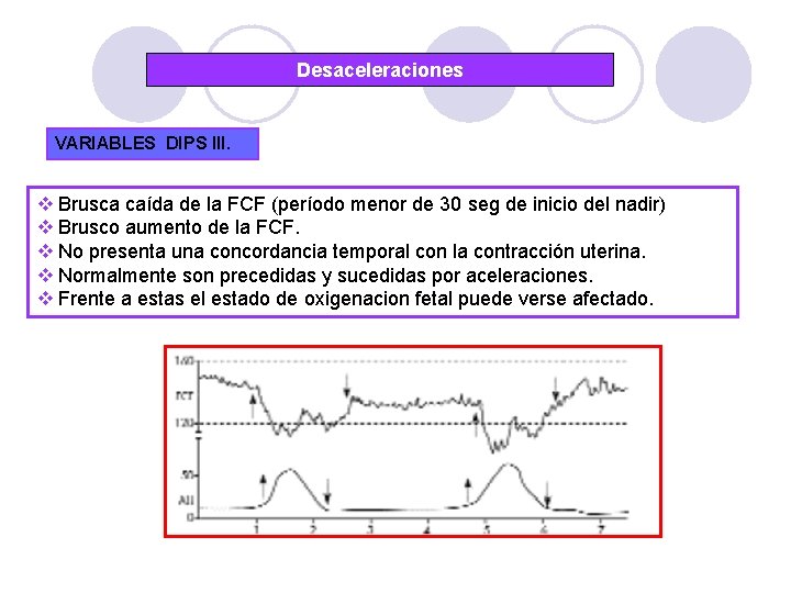Desaceleraciones VARIABLES DIPS III. v Brusca caída de la FCF (período menor de 30