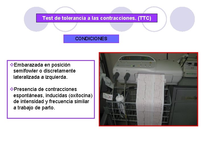 Test de tolerancia a las contracciones. (TTC) CONDICIONES v. Embarazada en posición semifowler o