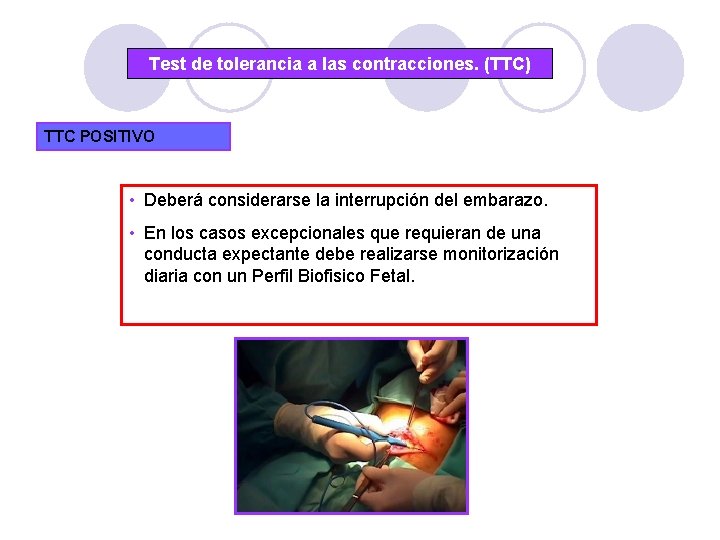 Test de tolerancia a las contracciones. (TTC) TTC POSITIVO • Deberá considerarse la interrupción