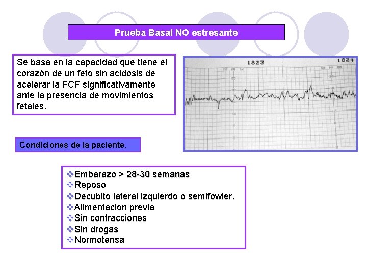 Prueba Basal NO estresante Se basa en la capacidad que tiene el corazón de