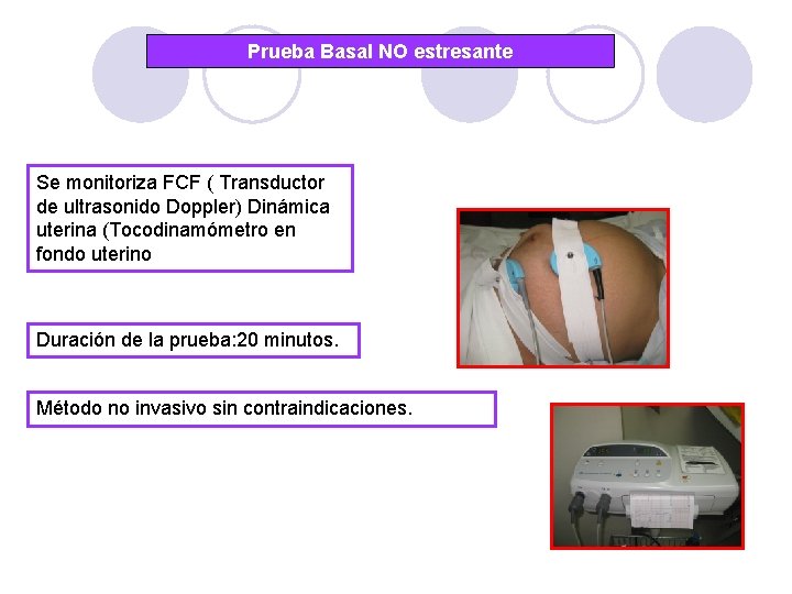 Prueba Basal NO estresante Se monitoriza FCF ( Transductor de ultrasonido Doppler) Dinámica uterina