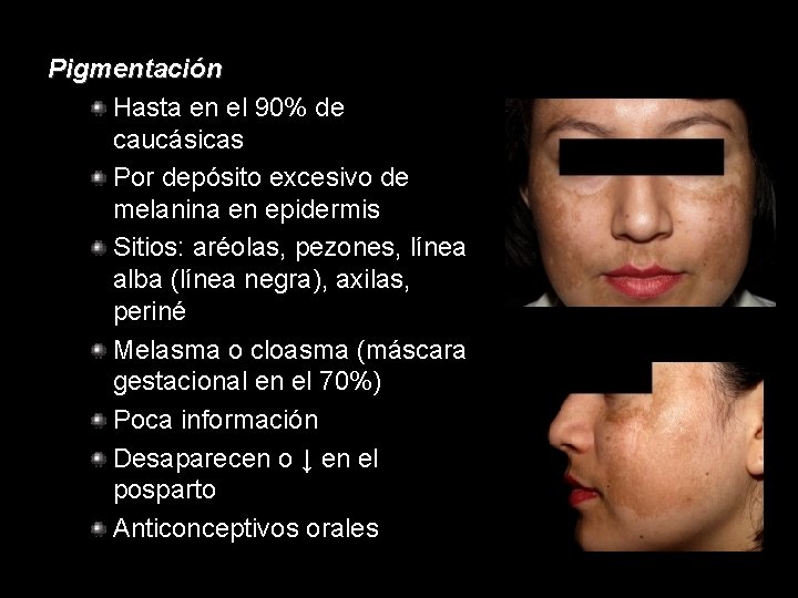 Pigmentación Hasta en el 90% de caucásicas Por depósito excesivo de melanina en epidermis