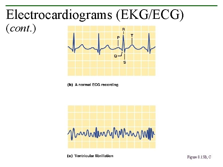 Electrocardiograms (EKG/ECG) (cont. ) Figure 8. 15 B, C Electrocardiograms (EKG/ECG) (cont. ) Figure 8. 15 B, C