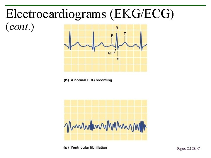 Electrocardiograms (EKG/ECG) (cont. ) Figure 8. 15 B, C 