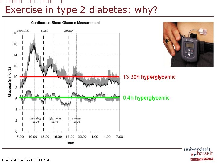 Exercise in type 2 diabetes: why? 13. 30 h hyperglycemic 0. 4 h hyperglycemic