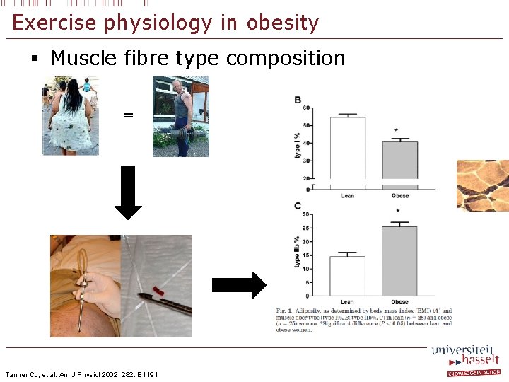 Exercise physiology in obesity § Muscle fibre type composition = Tanner CJ, et al.