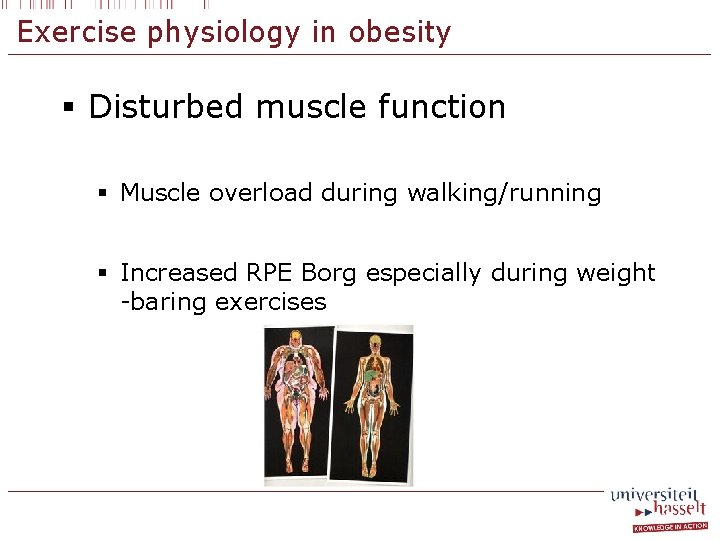 Exercise physiology in obesity § Disturbed muscle function § Muscle overload during walking/running §