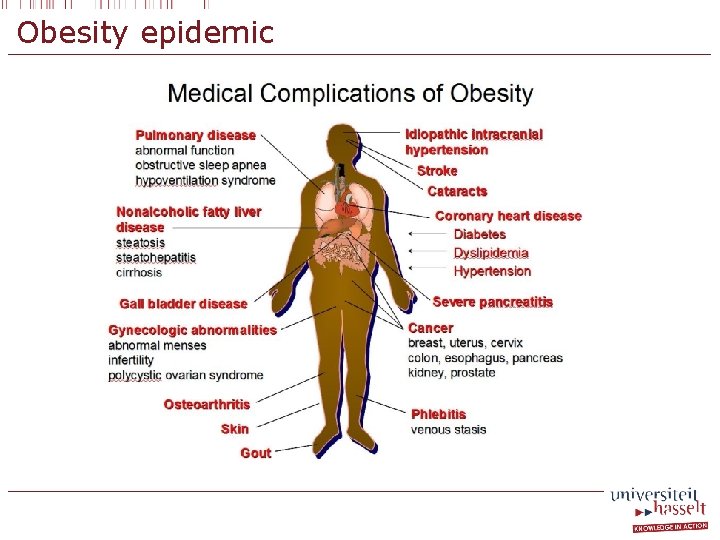 Obesity epidemic 