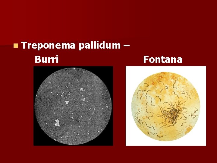 n Treponema Burri pallidum – Fontana 