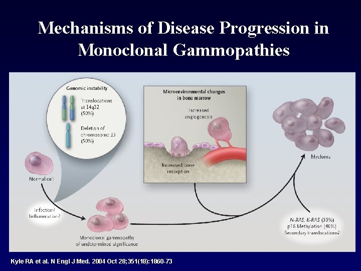 Mechanisms of Disease Progression in Monoclonal Gammopathies Kyle RA et al. N Engl J