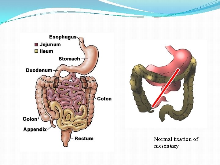 Normal fixation of mesentary 