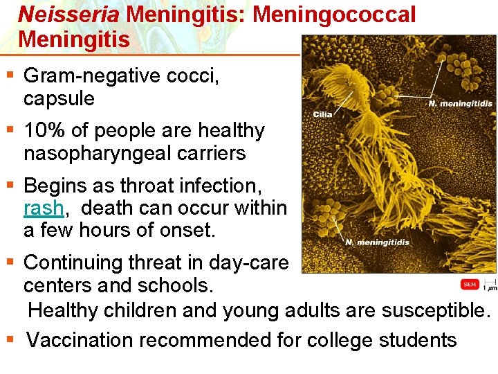 Neisseria Meningitis: Meningococcal Meningitis § Gram-negative cocci, capsule § 10% of people are healthy