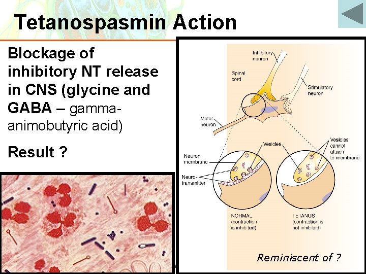 Tetanospasmin Action Blockage of inhibitory NT release in CNS (glycine and GABA – gammaanimobutyric