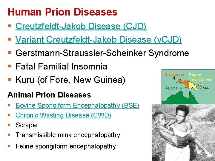 Human Prion Diseases § § § Creutzfeldt-Jakob Disease (CJD) Variant Creutzfeldt-Jakob Disease (v. CJD)