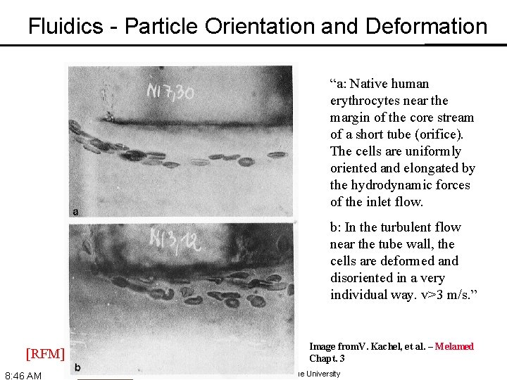 Fluidics - Particle Orientation and Deformation “a: Native human erythrocytes near the margin of