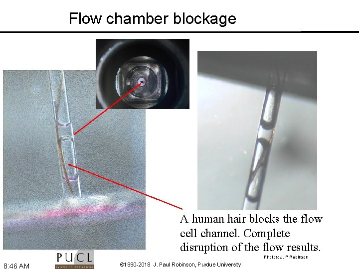 Flow chamber blockage A human hair blocks the flow cell channel. Complete disruption of