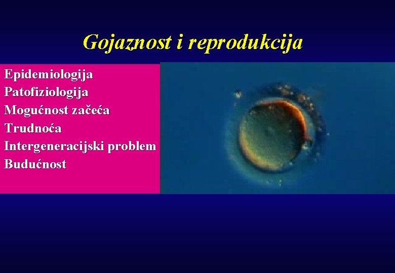 Gojaznost i reprodukcija Epidemiologija Patofiziologija Mogućnost začeća Trudnoća Intergeneracijski problem Budućnost 