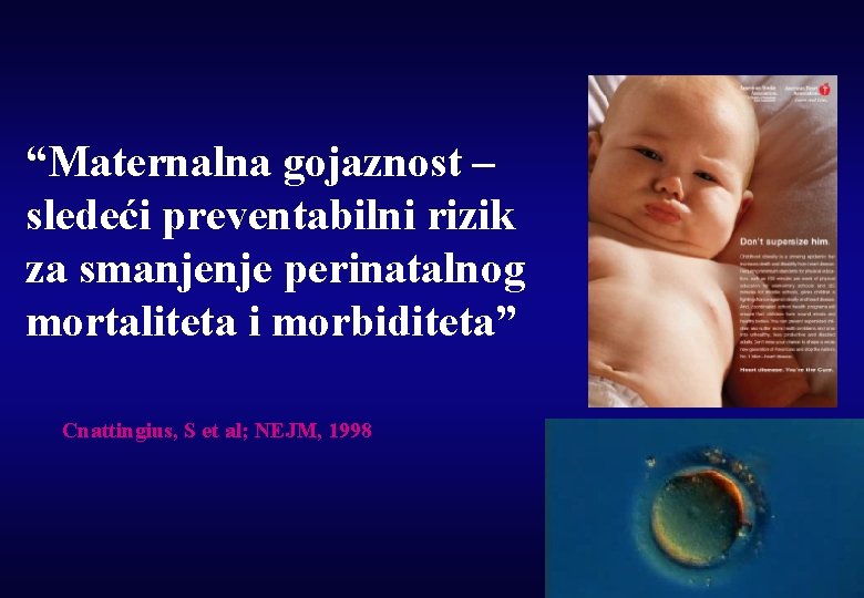 “Maternalna gojaznost – sledeći preventabilni rizik za smanjenje perinatalnog mortaliteta i morbiditeta” Cnattingius, S