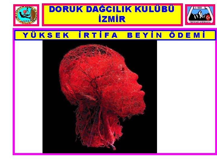 DORUK DAĞCILIK KULÜBÜ İZMİR YÜKSEK İRTİFA BEYİN ÖDEMİ 