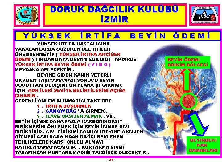 DORUK DAĞCILIK KULÜBÜ İZMİR YÜKSEK İRTİFA BEYİN ÖDEMİ YÜKSEK İRTİFA HASTALIĞINA YAKALANLARDA GÖZÜKEN BELİRTİLER