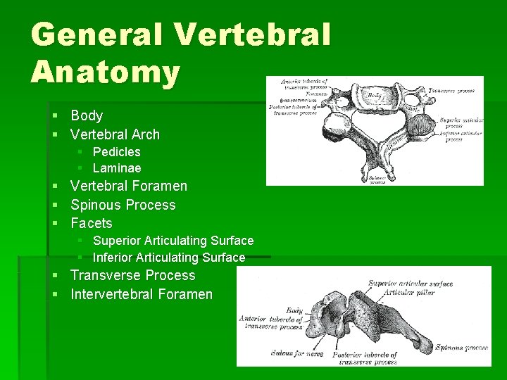 General Vertebral Anatomy § Body § Vertebral Arch § Pedicles § Laminae § § General Vertebral Anatomy § Body § Vertebral Arch § Pedicles § Laminae § §