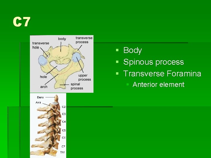C 7 § Body § Spinous process § Transverse Foramina § Anterior element 