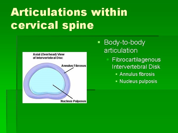 Articulations within cervical spine § Body-to-body articulation § Fibrocartilagenous Intervertebral Disk § Annulus fibrosis
