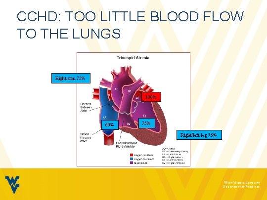 CCHD: TOO LITTLE BLOOD FLOW TO THE LUNGS Right arm 75% 100% 60% 75%