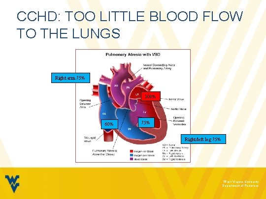 CCHD: TOO LITTLE BLOOD FLOW TO THE LUNGS Right arm 75% 100% 60% 75%