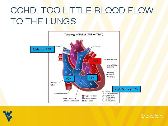 CCHD: TOO LITTLE BLOOD FLOW TO THE LUNGS Right arm 85% 100% 60% 85%