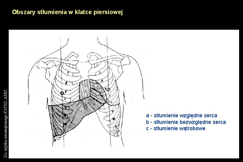 Do użytku wewnętrznego KNTi. D AMG Obszary stłumienia w klatce piersiowej a - stłumienie