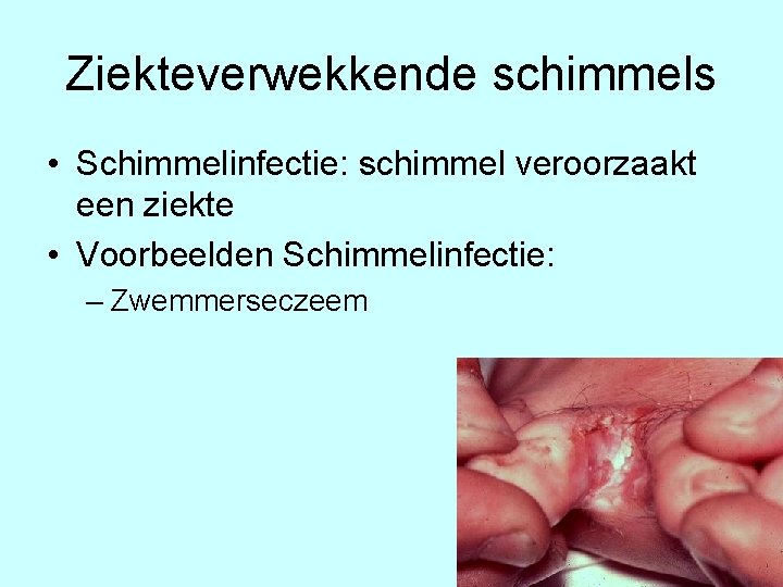 Ziekteverwekkende schimmels • Schimmelinfectie: schimmel veroorzaakt een ziekte • Voorbeelden Schimmelinfectie: – Zwemmerseczeem 