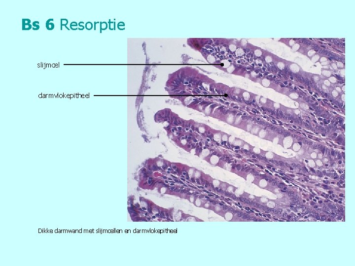 Bs 6 Resorptie slijmcel darmvlokepitheel Dikke darmwand met slijmcellen en darmvlokepitheel 