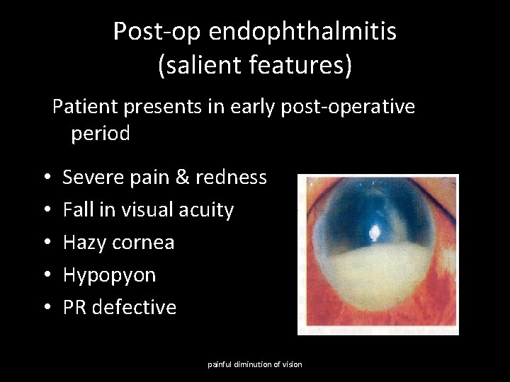 Post-op endophthalmitis (salient features) Patient presents in early post-operative period • • • Severe
