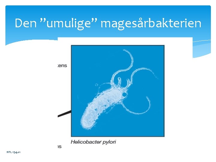 Den ”umulige” magesårbakterien NTL 15. 9. 11 