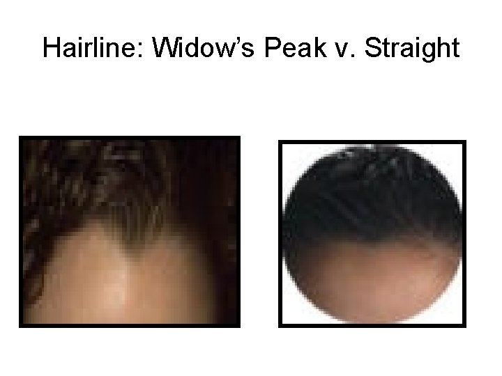 Hairline: Widow’s Peak v. Straight 